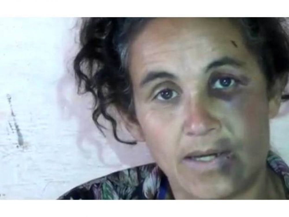 Casilda: la Justicia investiga la denuncia de una mujer golpeada por la polic�a