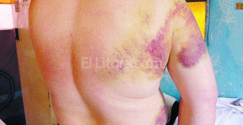 "Ellos llegaron con palos y armas, nosotros ten�amos termo y mate"