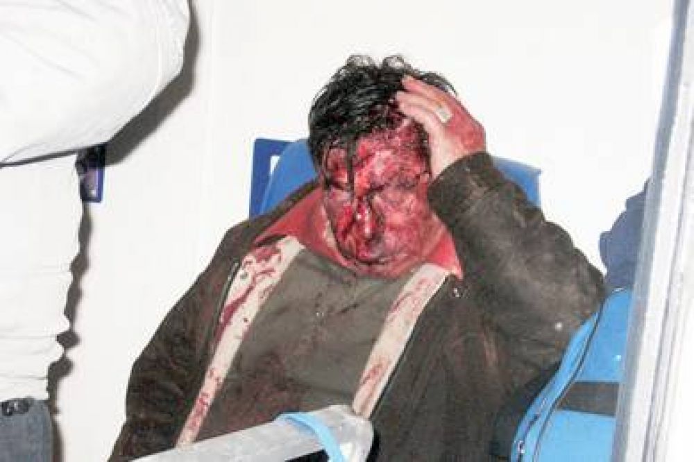 Ataque brutal a chacarero para robarle y en otro asalto lastiman con cuchillo a estudiante