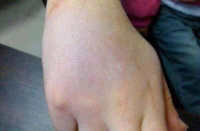 Joven sufri� un ataque por parte de su ex pareja