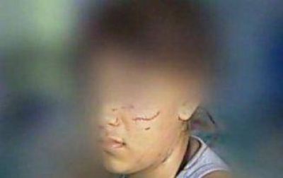 Adolescente recibi� una golpiza de otra a la salida de la Escuela Media N� 6
