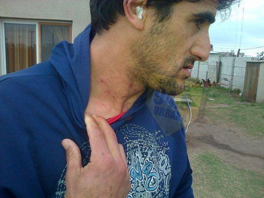 Emilio V. Bunge: Detienen a una mujer tras agredir y tener en cautiverio varias horas a su ex pareja