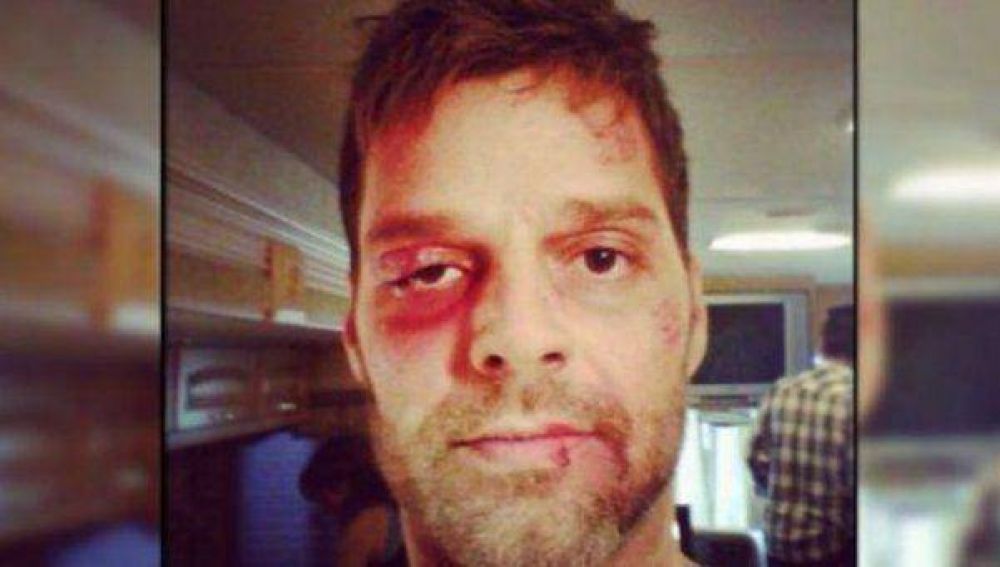 La impactante foto de Ricky Mart�n que conmovi� Twitter
