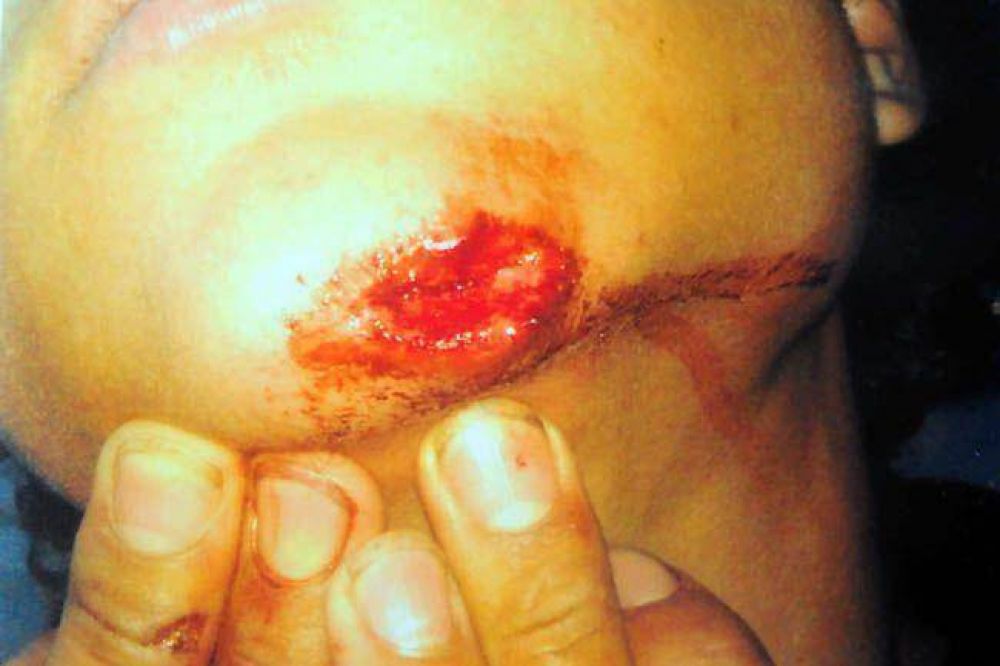 Denuncian golpiza a un menor en comisar�a de Pico