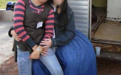 Coronel Pringles: Joven que sufre de elefantiasis ser� operada gratis en Buenos Aires
