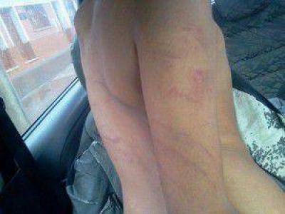 Familiares y amigos de un menor golpeado brutalmente por su padre marcharon pidiendo justicia