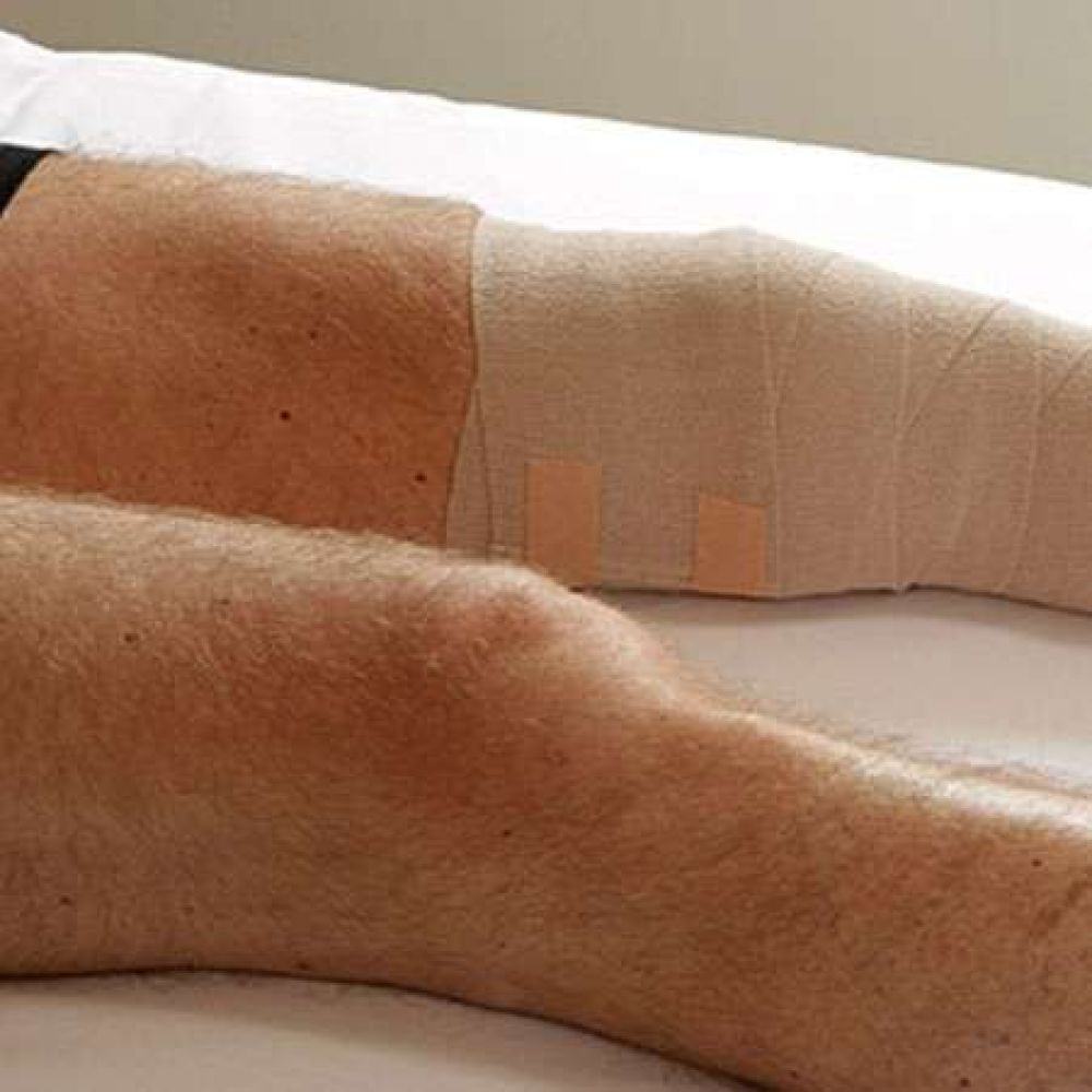 La dura historia del joven que quer�a ser polic�a, pero perdi� una pierna en accidente