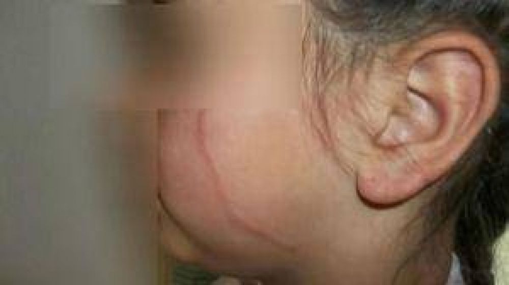 Denuncian que una menor fue golpeada por sus compa�eros