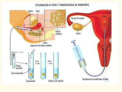 Obras sociales no cubren tratamientos de fertilidad