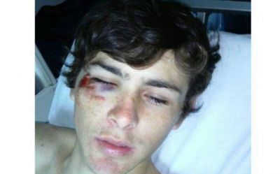 Polic�a lo agarr� a palazos a la salida de un boliche 