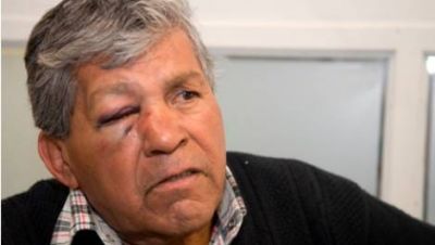 Cruz� al ladr�n de su casa y sufri� una golpiza