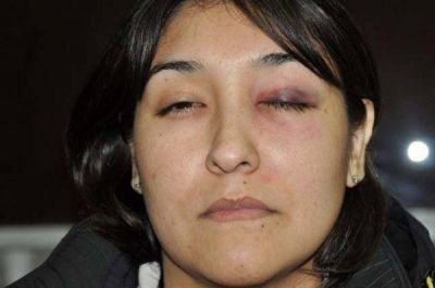 Interna barrial: Feroz golpiza a dirigente vecinal del Arraigo Sur 