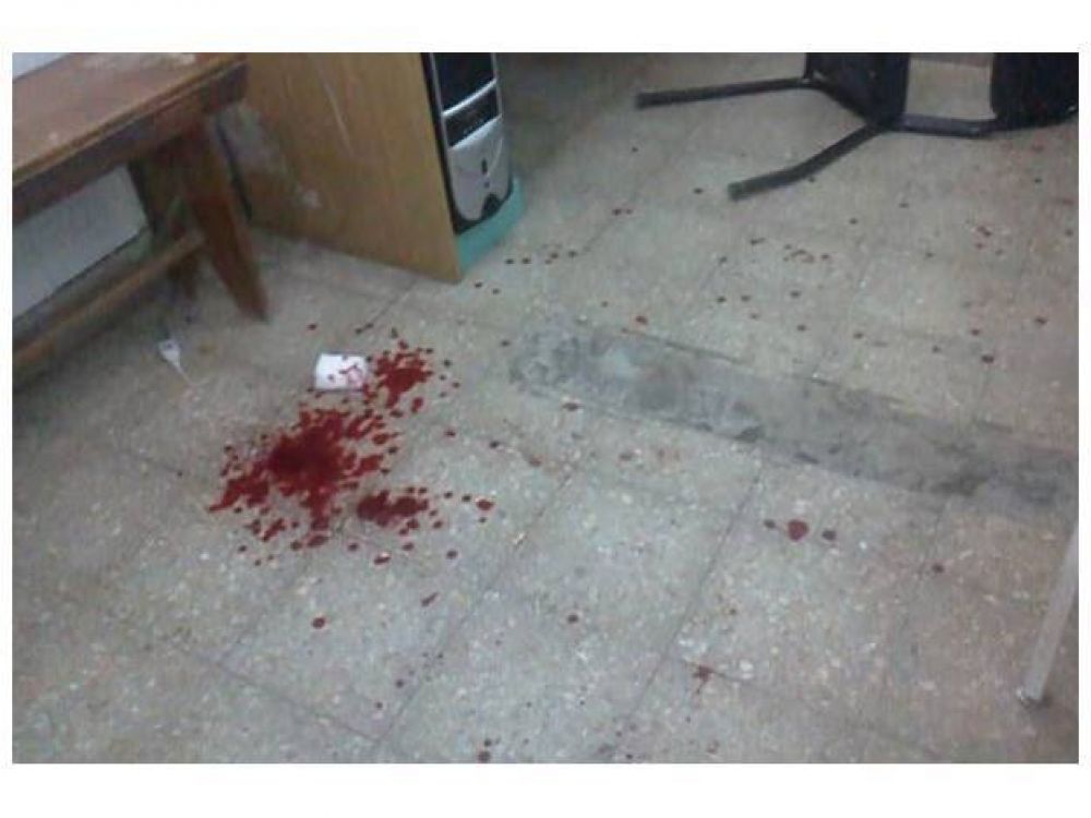 Golpean y tajean empleadas de un centro de salud de Santa Fe