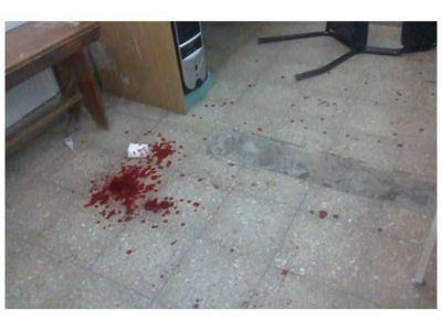 Golpean y tajean empleadas de un centro de salud de Santa Fe