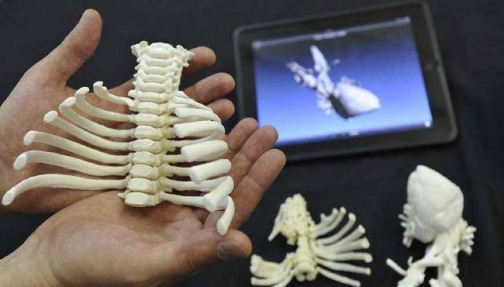 Crean biomodelos 3D para mejorar los abordajes m�dicos