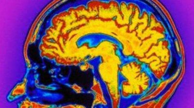 El cerebro humano disfruta al ver sufrir a sus enemigos