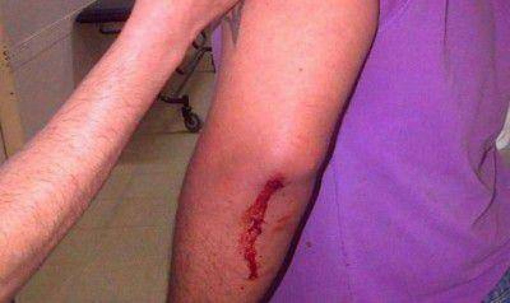 Balean a un militante del Frente Renovador de Campana cuando realizaba una pegatina de carteles