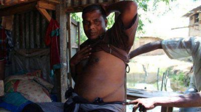 En Bangladesh venden �rganos para poder pagar deudas