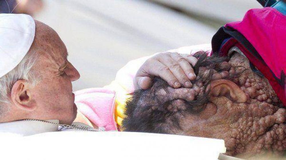 El Papa bendijo a una persona con una extra�a enfermedad