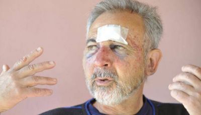 Lo ataron y lo torturaron en un asalto en Villa Esqui�