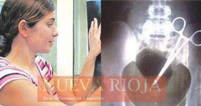 Le extrajeron la pinza olvidada en el vientre de la joven madre