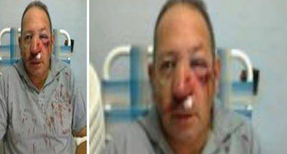 Feroz asalto a un taxista